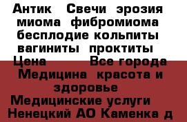 Антик.  Свечи (эрозия, миома, фибромиома, бесплодие,кольпиты, вагиниты, проктиты › Цена ­ 550 - Все города Медицина, красота и здоровье » Медицинские услуги   . Ненецкий АО,Каменка д.